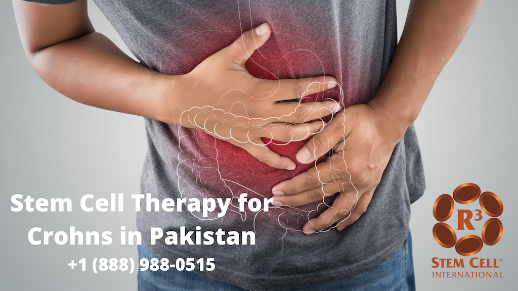 Stem Cell Crohns Pakistan