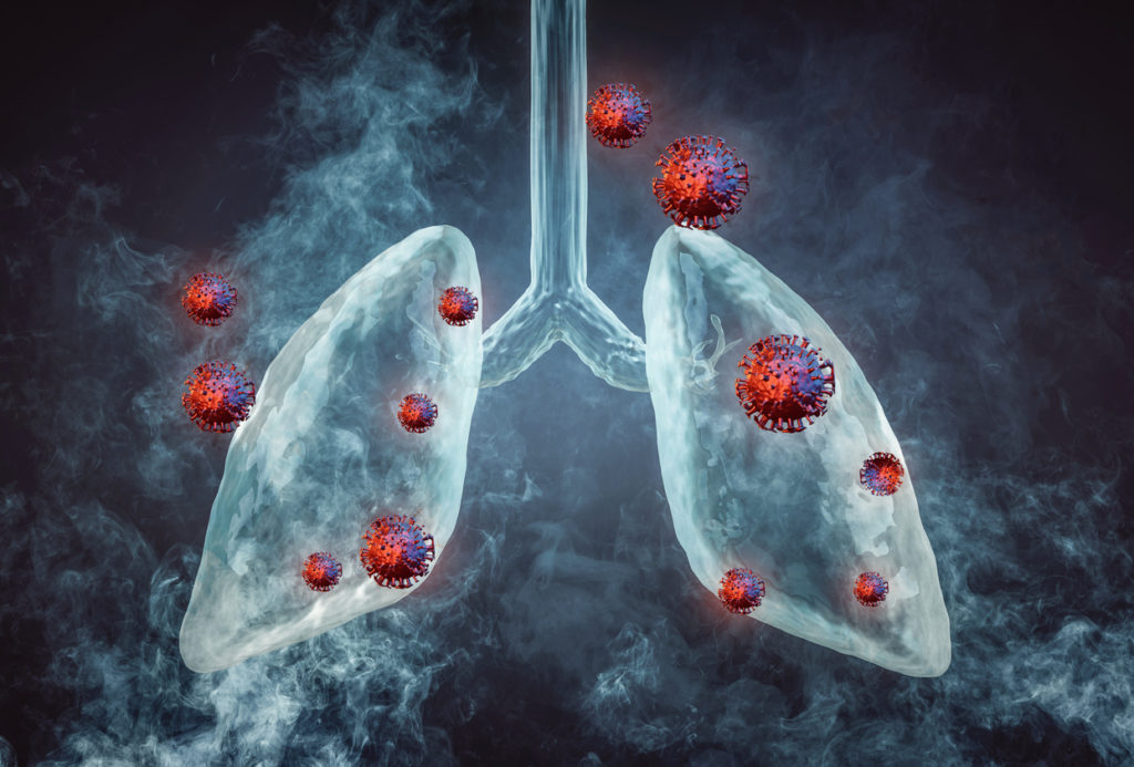 stem cell lung Pakistan