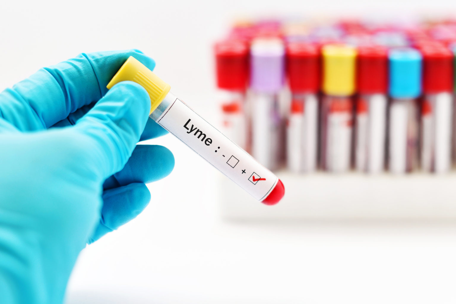 stem cell treatment for lyme disease stem cell treatment for lyme disease