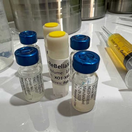 Stem-Cell-Exosome-Vials-with-PRP