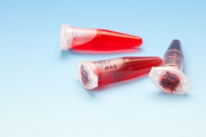 Stem Cell Treatment Arizona 