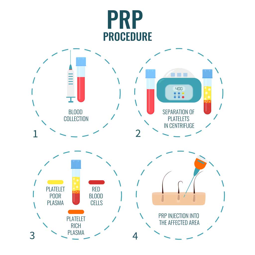 Regenerative Medicine And Stem Cell Therapy Scottsdale Az 5233