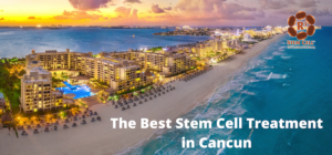 Stem Cell Cancun