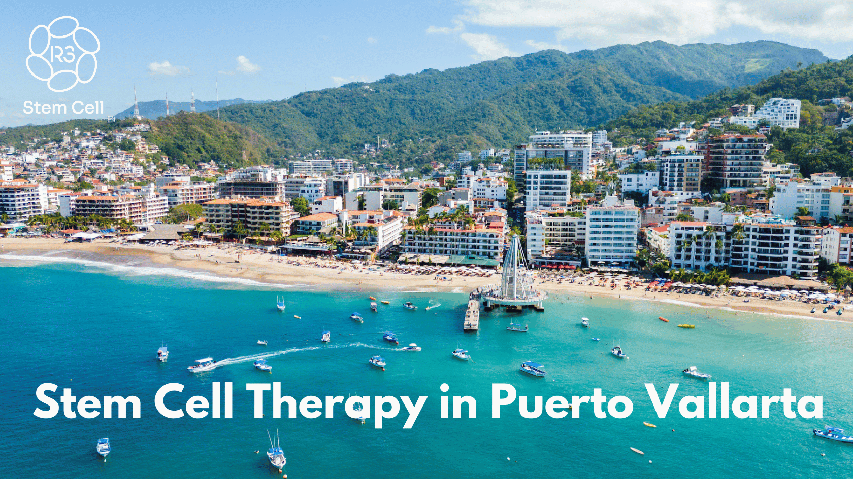 Stem Cell Treatment Puerto Vallarta Mexico