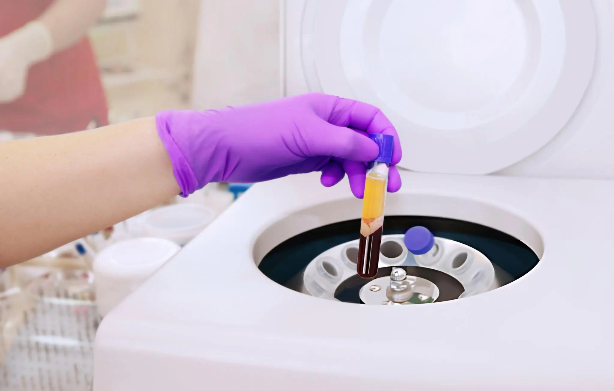 A gloved hand holding a test tube containing a blood sample in a centrifuge, symbolizing laboratory diagnostics often essential for understanding conditions like diabetic peripheral neuropathy and its systemic complications.