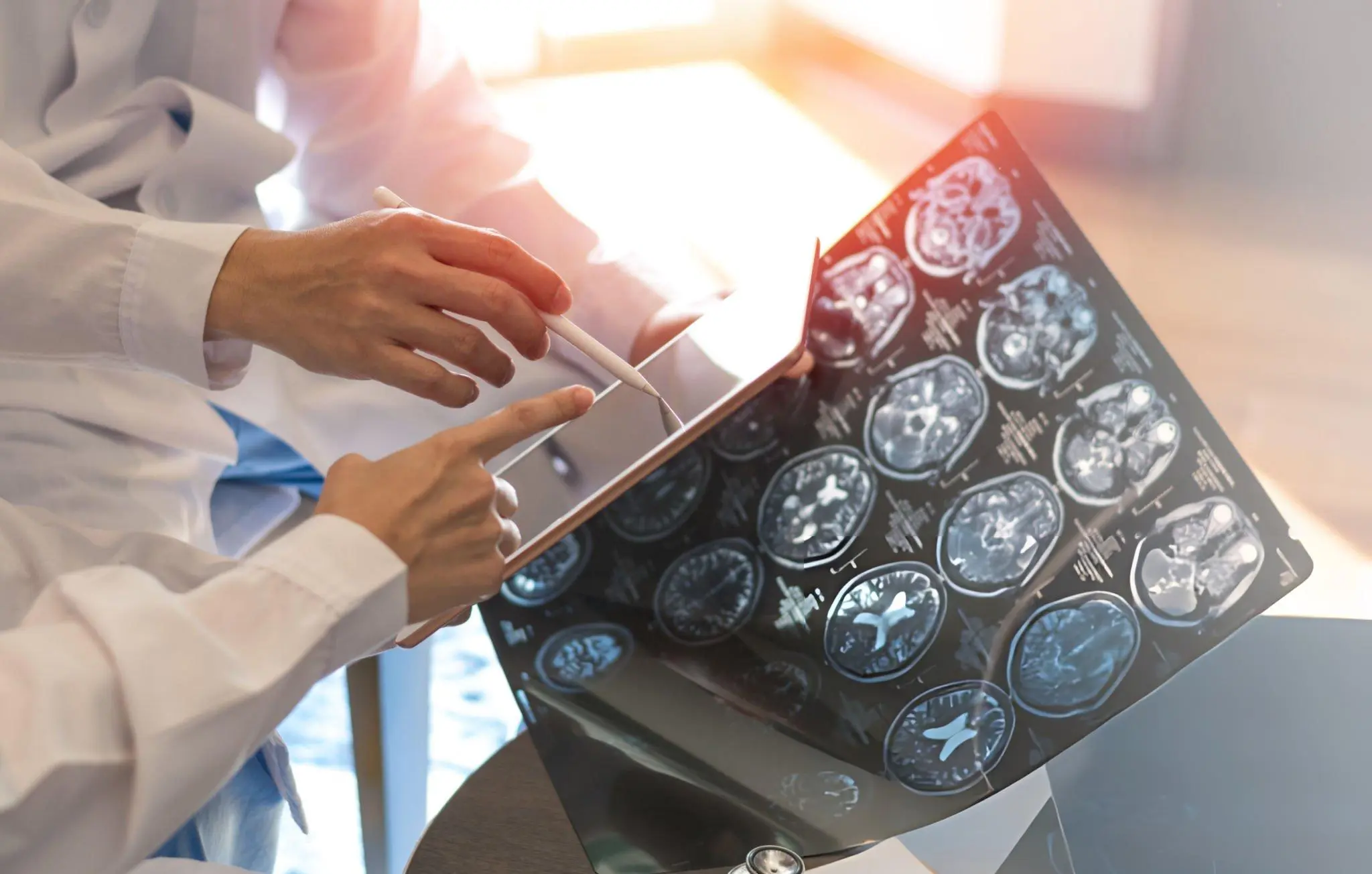 Medical professionals examining detailed brain scans on a tablet, symbolizing the diagnostic and analytical focus required for understanding and treating Multiple Sclerosis.