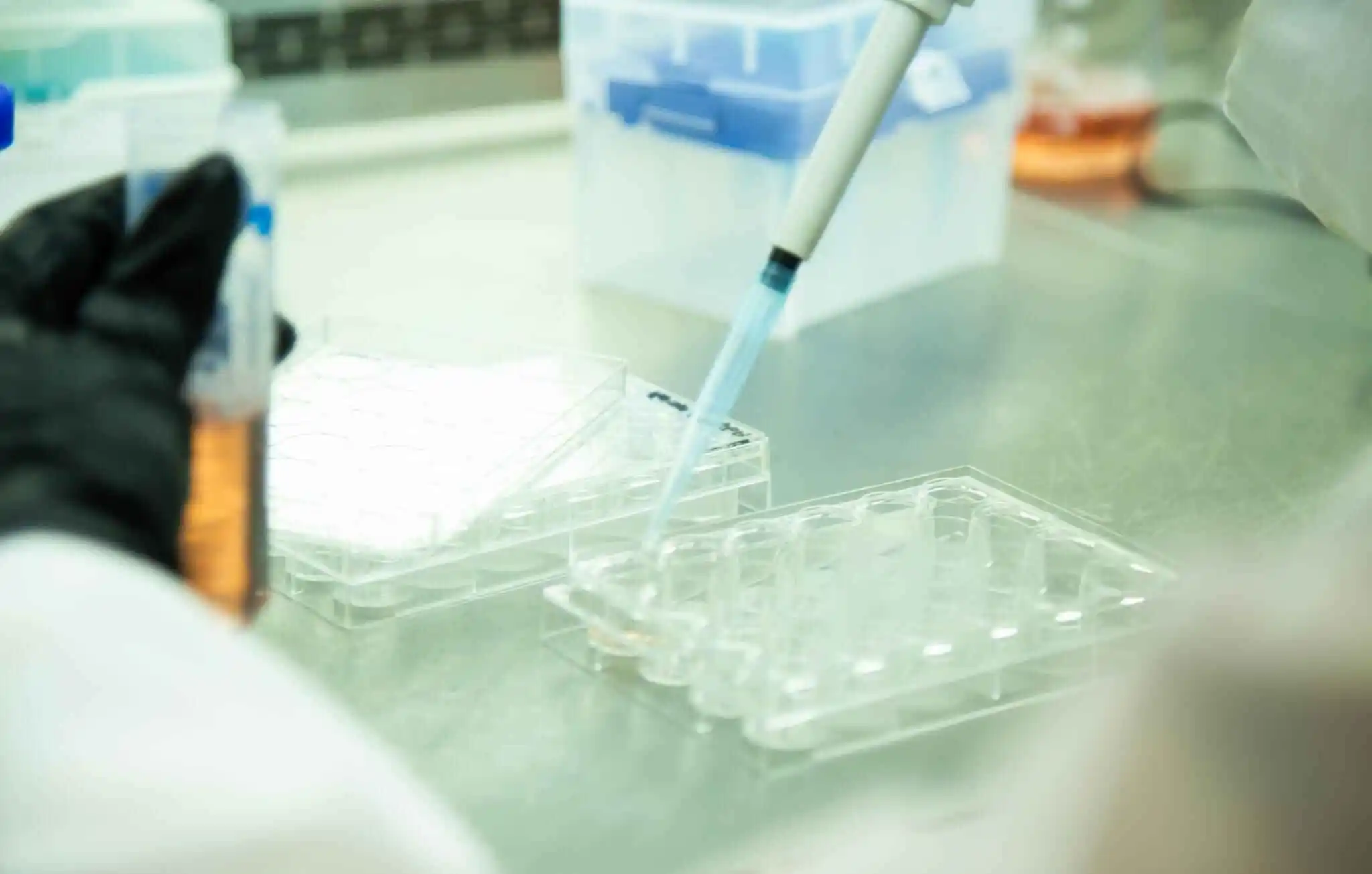 Gloved hands working in a laboratory setting, using a pipette and multi-well plate to carefully handle regenerative biologics derived from umbilical cord tissue.