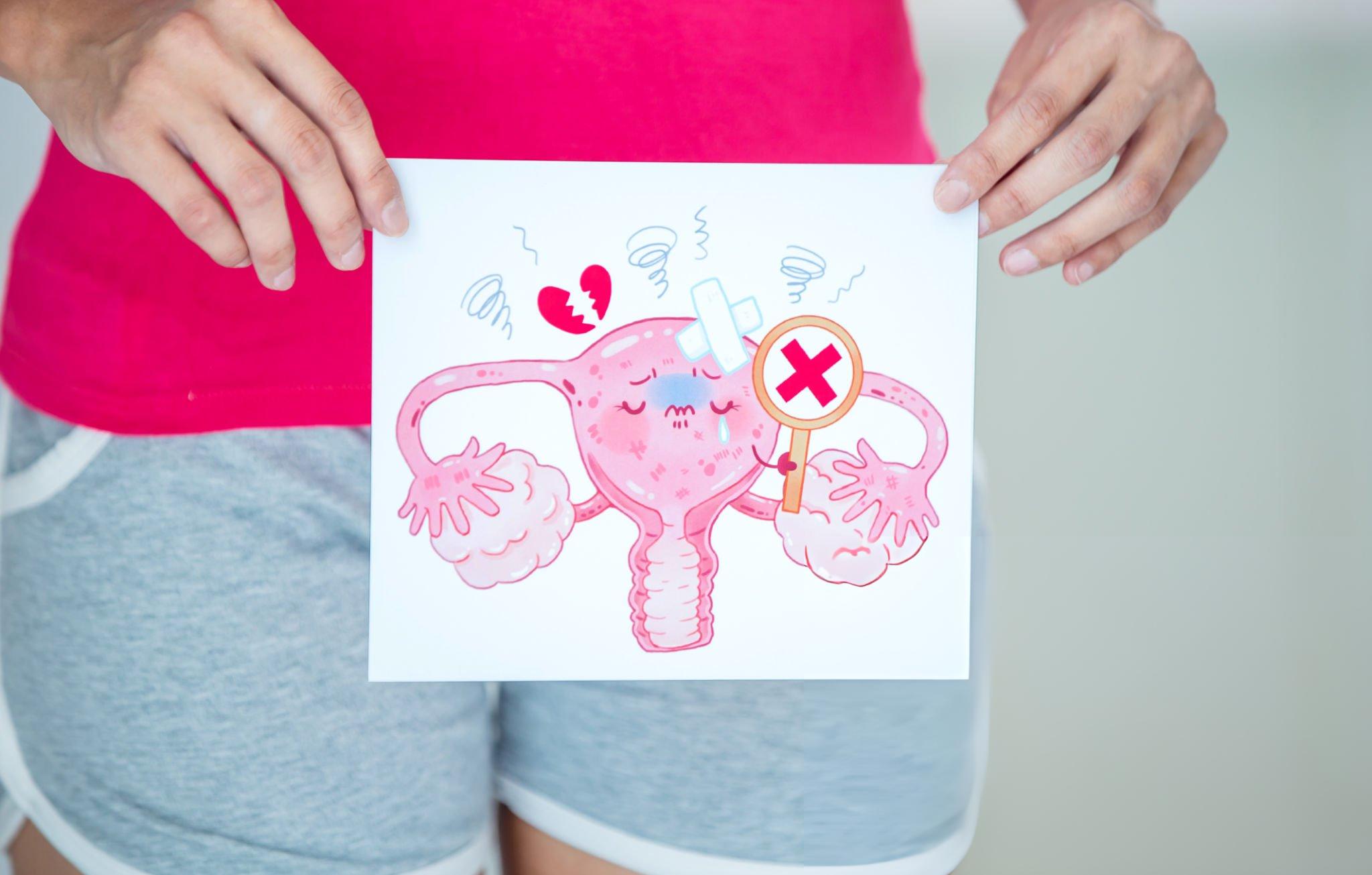 A hand-drawn illustration of a uterus with medical symbols like a magnifying glass with a red cross, bandages, and a broken heart, emphasizing research and therapeutic advancements in conditions like POI (Premature Ovarian Insufficiency).