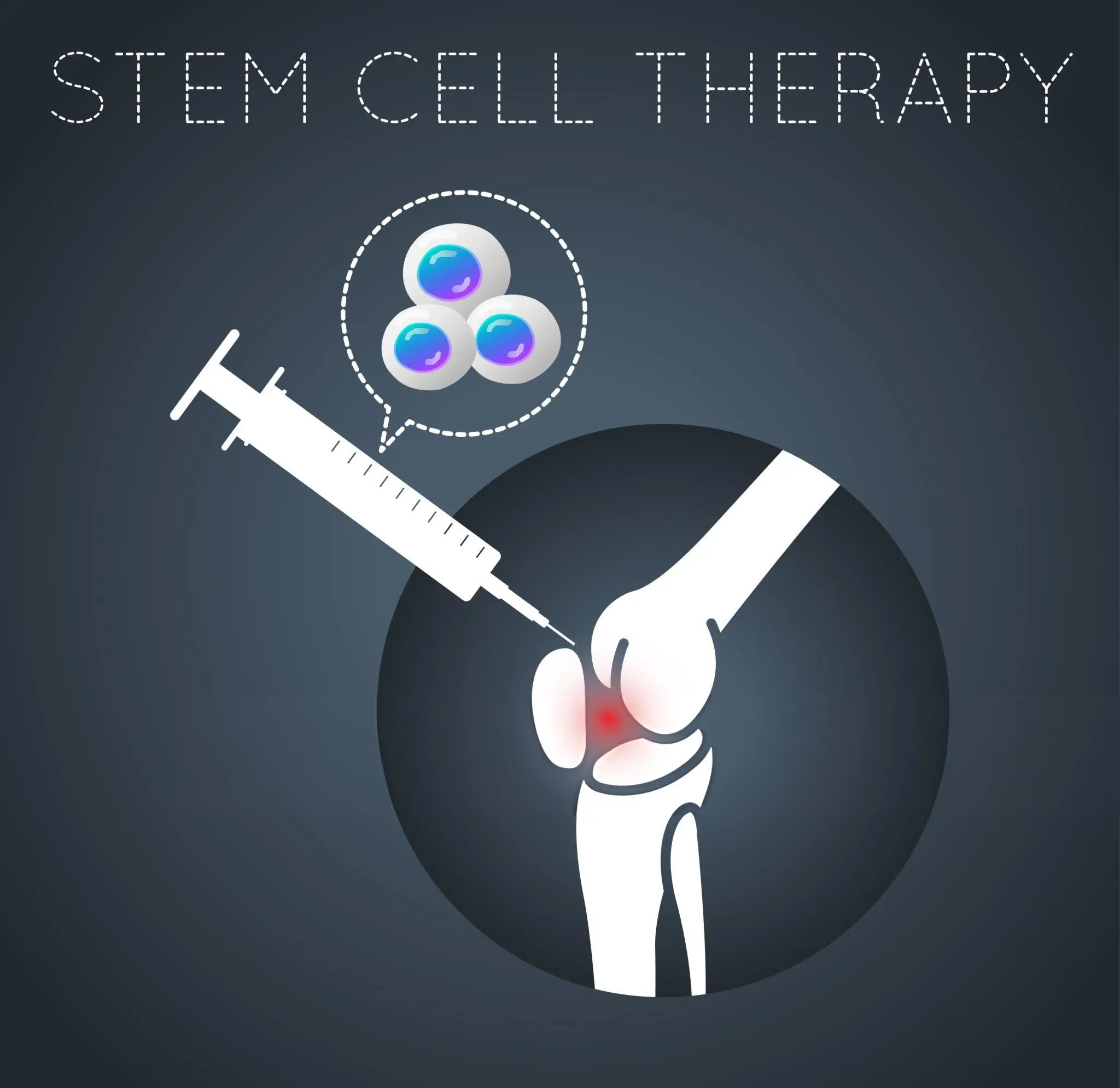 Stem Cell Therapy and Chronic Conditions
