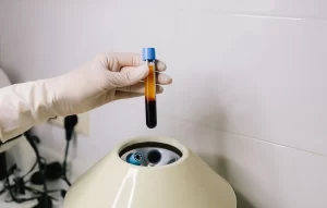 A laboratory technician in white protective gloves holding a centrifuged blood sample test tube with distinctly separated layers of amber plasma and dark red blood cells over a medical centrifuge machine.