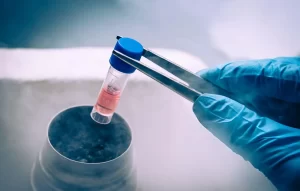 A laboratory technician in blue protective gloves using metal forceps to remove a cryopreservation vial of stem cells from ultra-low temperature liquid nitrogen storage.
