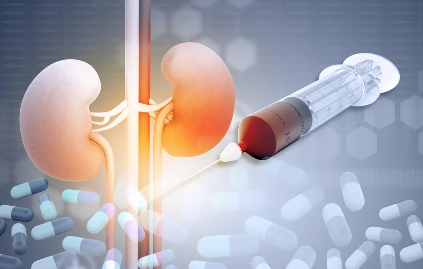 Medical illustration of kidneys and stem cell injection representing IV infusion and renal artery delivery for chronic kidney disease treatment.