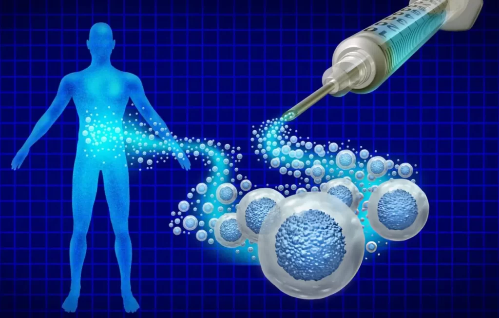 An abstract medical illustration depicting stem cell therapy, showing a syringe injecting a stream of glowing blue cells that flow into the torso of a translucent blue human silhouette against a dark blue grid background.