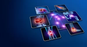 Human body graphic showing glowing joint inflammation pain points