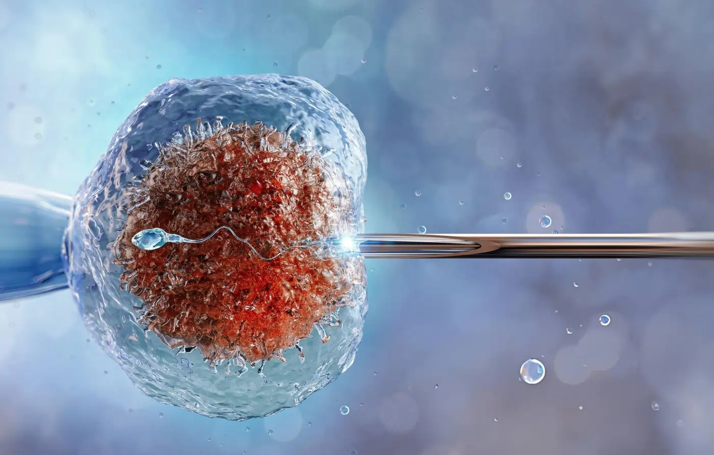 3D medical illustration showing Intracytoplasmic Sperm Injection (ICSI) with a micropipette holding an egg cell during IVF treatment.