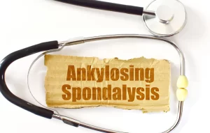 Medical stethoscope framing ankylosing spondylitis stem cell therapy topic