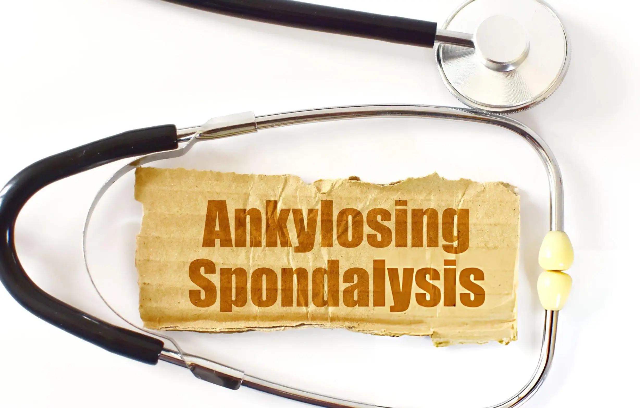 Medical stethoscope framing ankylosing spondylitis stem cell therapy topic