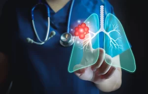 Medical professional analyzing a glowing digital diagram of human lungs highlighting inflammation and lung disease treatment.