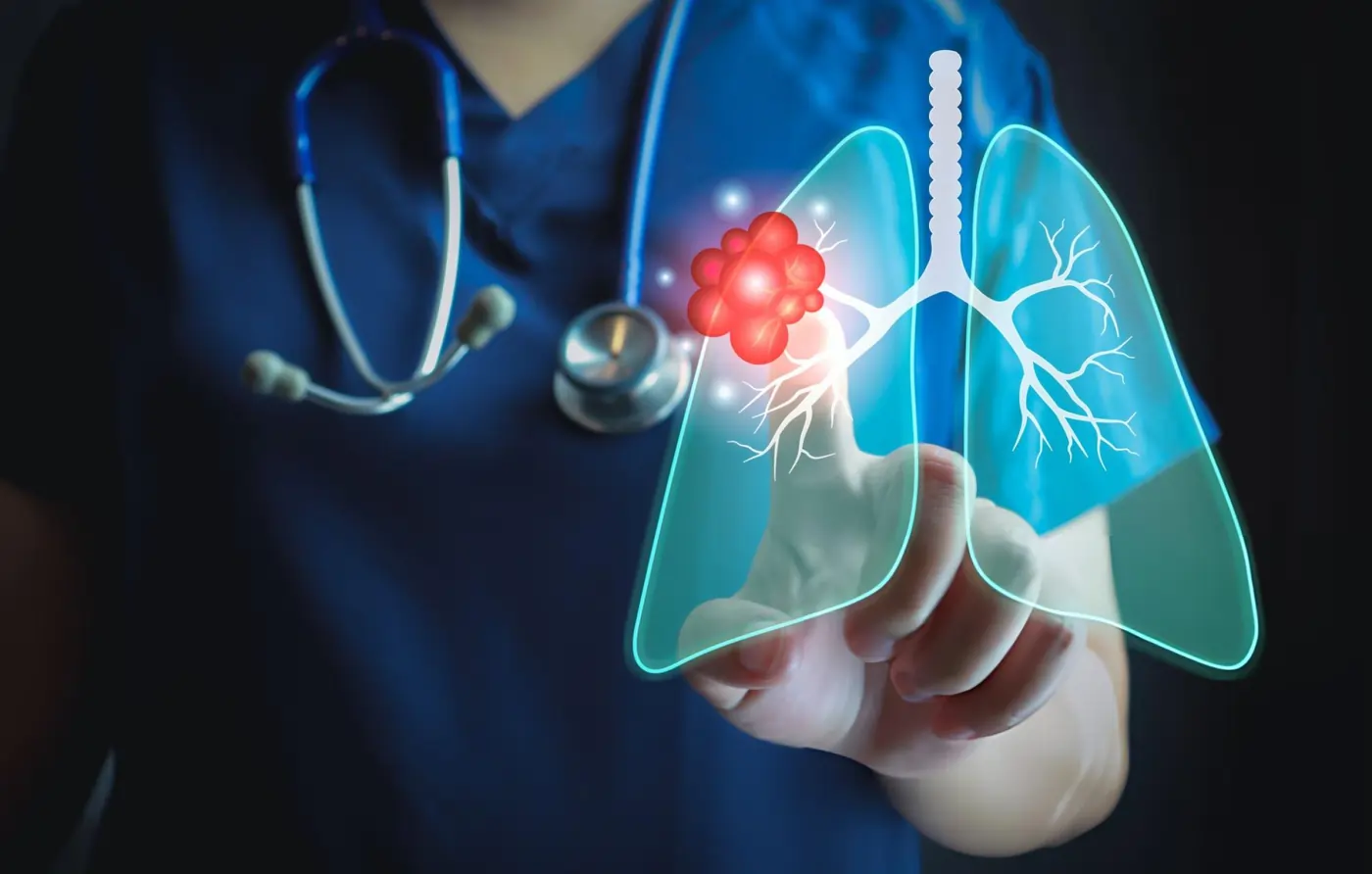 Medical professional analyzing a glowing digital diagram of human lungs highlighting inflammation and lung disease treatment.