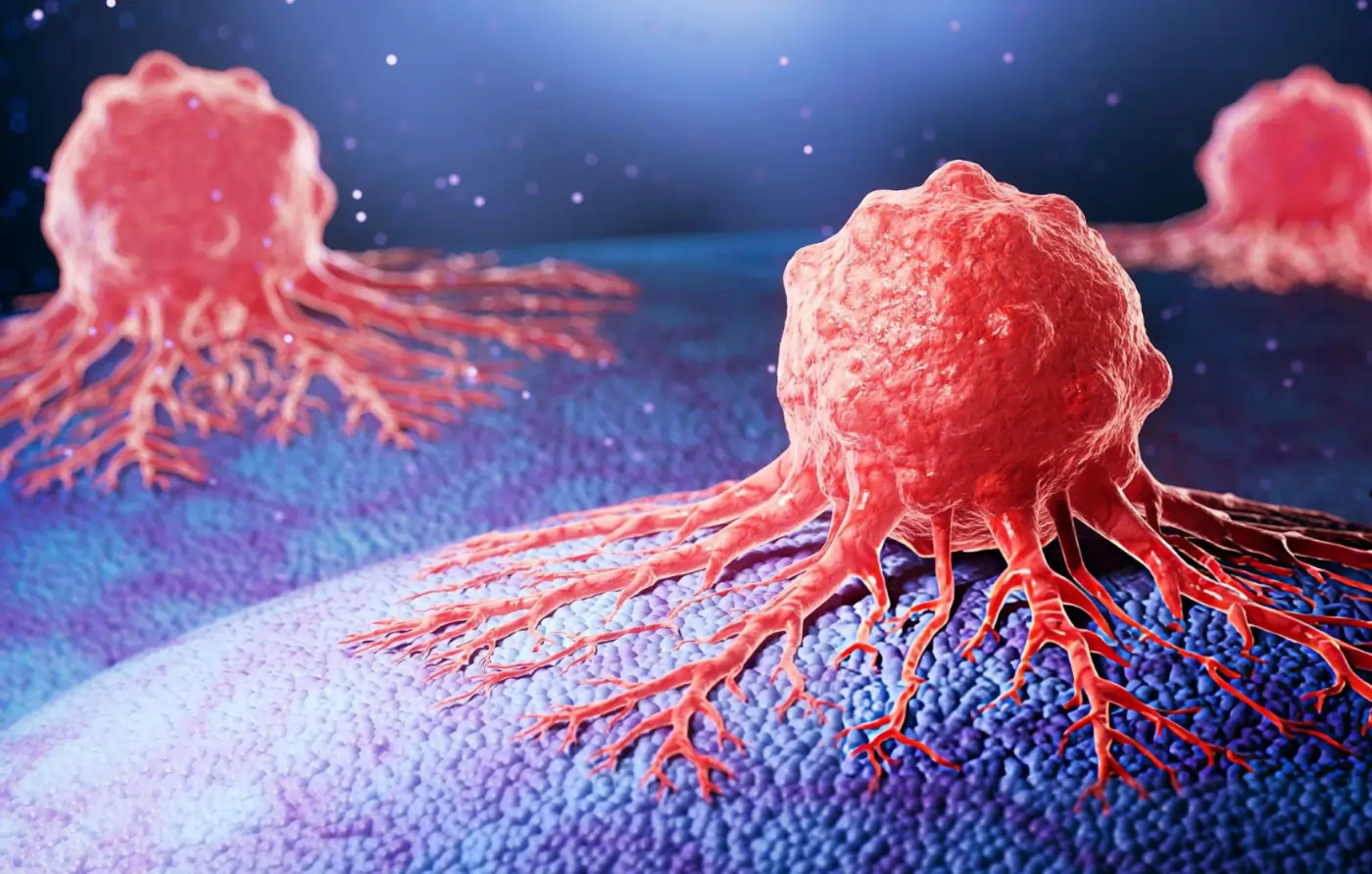 Medical 3D illustration depicting cellular tumor growth structure to explain the safety profile and teratoma risks associated with pluripotent versus multipotent stem cell therapies.