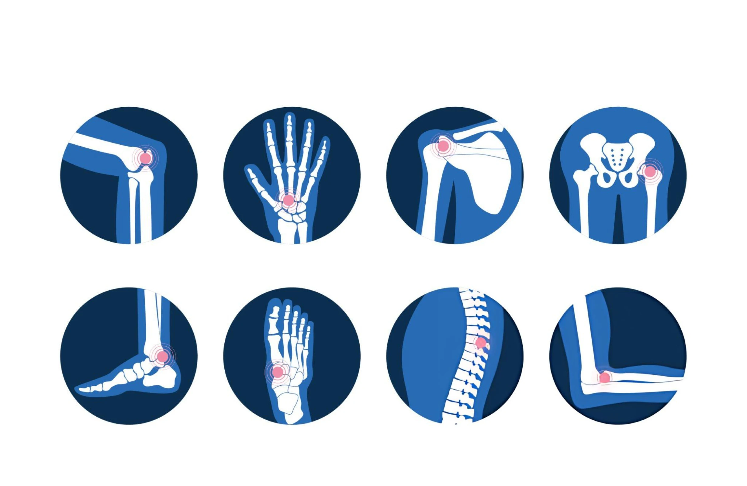 Diagram showing joint pain sites suitable for stem cell injections