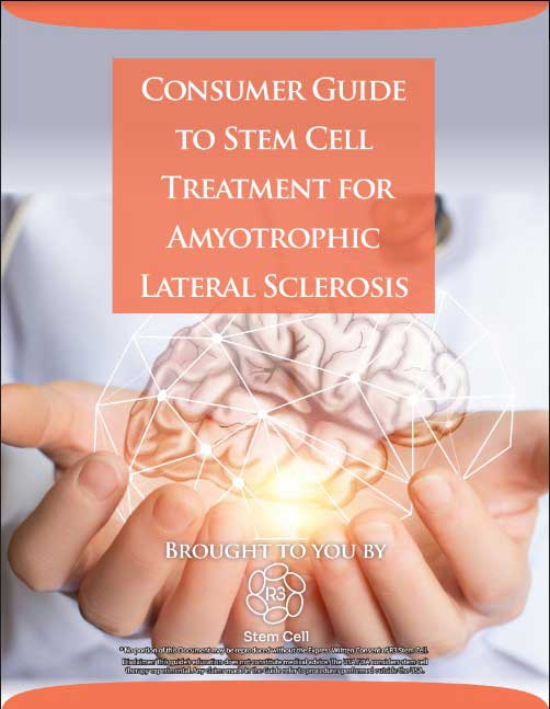 R3 Stem Cell Guide for Amyotrophic Lateral Sclerosis (ALS)
