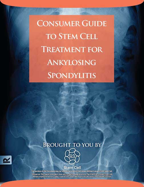 R3 Stem Cell Guide for Ankylosing Spondylitis