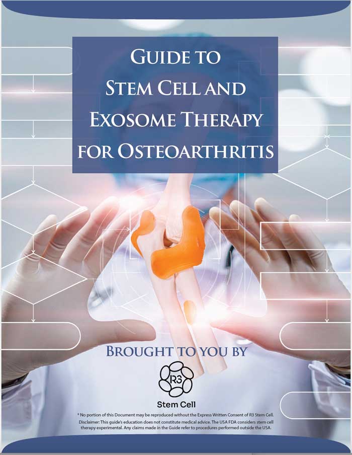 R3 Stem Cell Consumer Guide for Arthritis