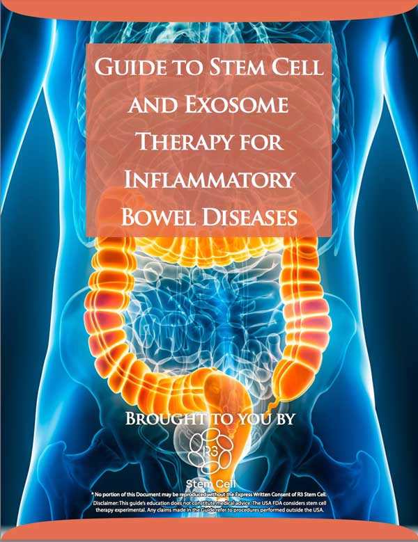 R3 Stem Cell Guide for Inflammatory Bowel Disease (IBD)