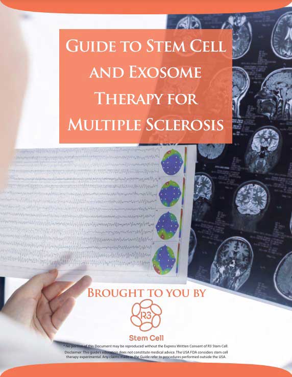 R3 Stem Cell Multiple Sclerosis Guide