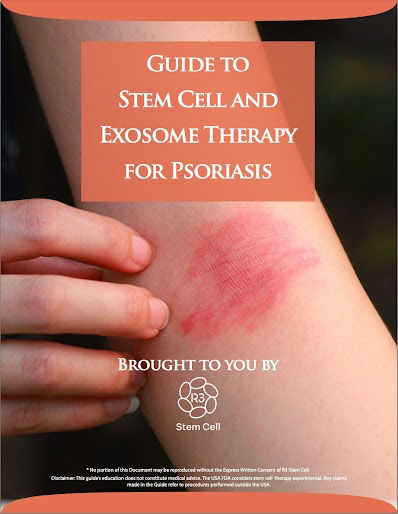 R3 Stem Cell Guide for Psoriasis