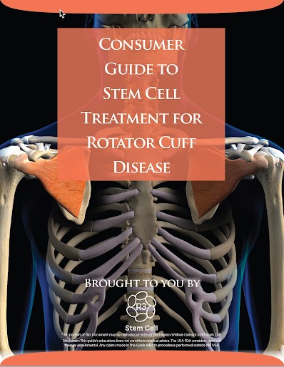 R3 Stem Cell Consumer Guide for Rotator Cuff Disease