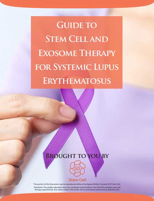 R3 Stem Cell Guide for Lupus – SLE