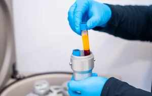 Medical clinician preparing platelet-rich plasma for soft tissue repair