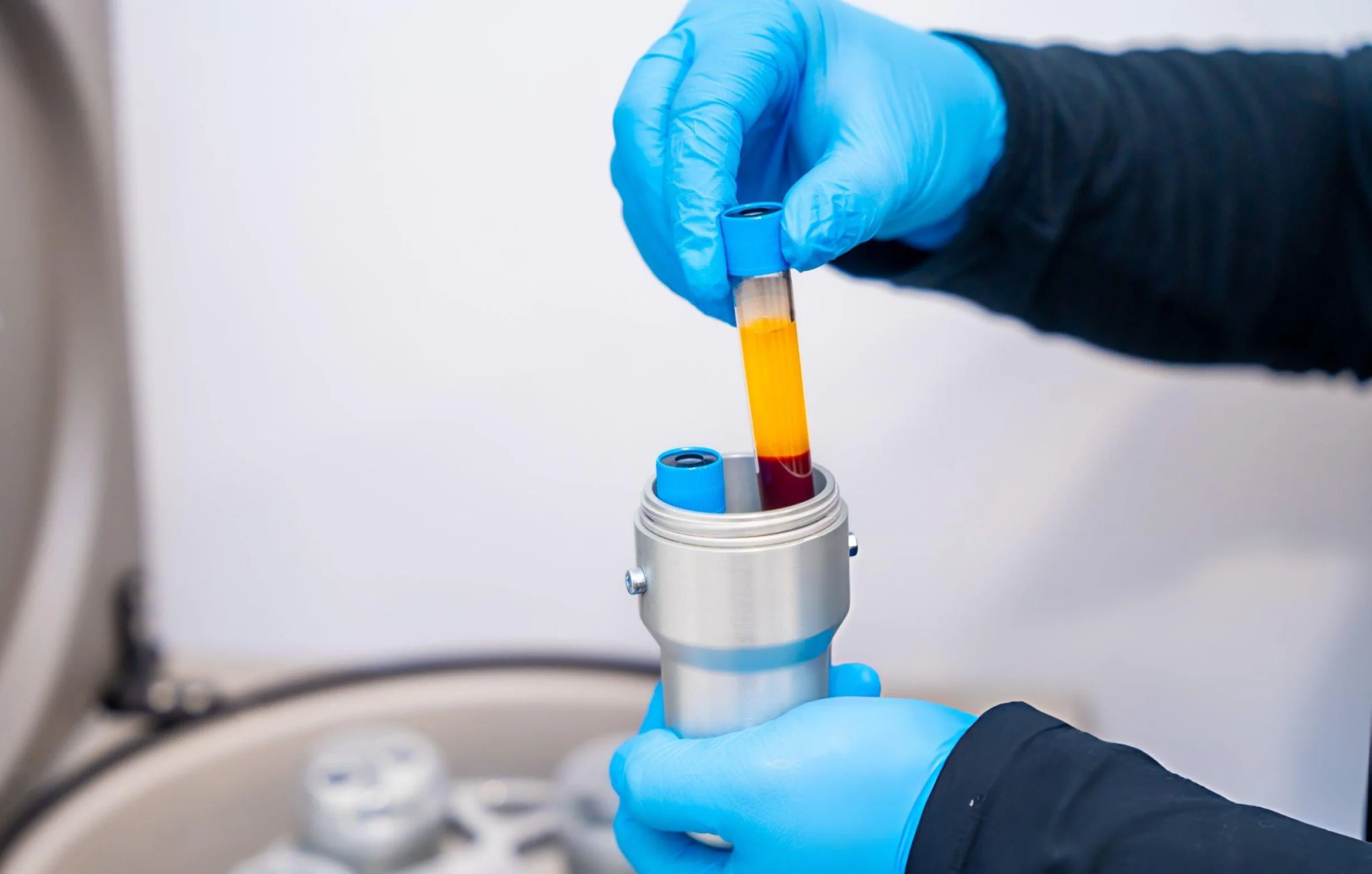Medical clinician preparing platelet-rich plasma for soft tissue repair