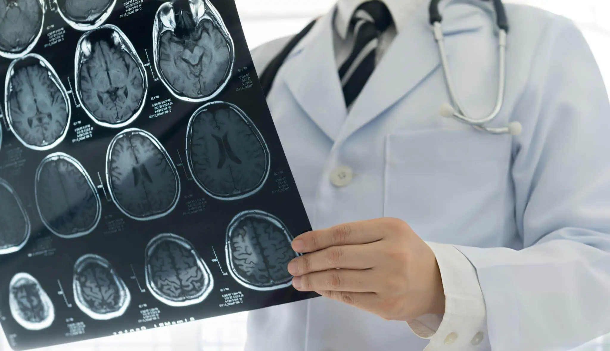 A doctor analyzing brain MRI scans to plan treatments for ischemic and hemorrhagic strokes.