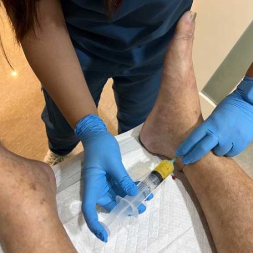 Neuropathy-Injection5-qlpvwt5z4sc1zhsx1zsjxxf20jlck9pdvv85wost8c